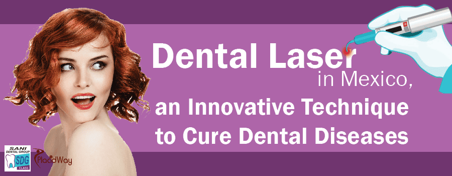 Dental Laser in Mexico, an Innovative Technique to Cure Dental Diseases